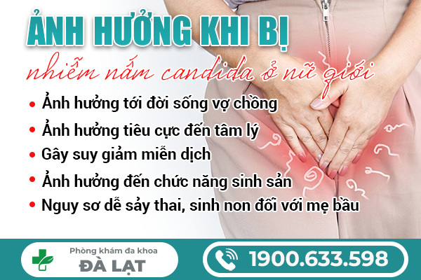 Hình ảnh minh họa